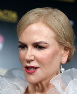 Nicole Kidman próbuje zatrzymać czas. Lekarz wylicza, co poprawiła w twarzy