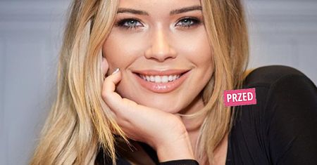 Sandra Kubicka poprawiła urodę. "Stało się to moim kompleksem". Zachwycona efektami pochwaliła się nimi na IG
