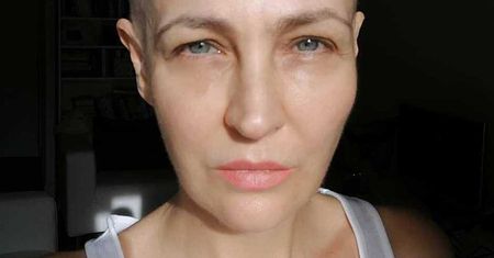 Anna Puślecka pokazała swój "posiłek" za 600 złotych. Tak wygląda śniadanie chorej na raka gwiazdy