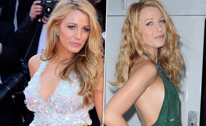 Blake Lively - po i przed operacją biustu