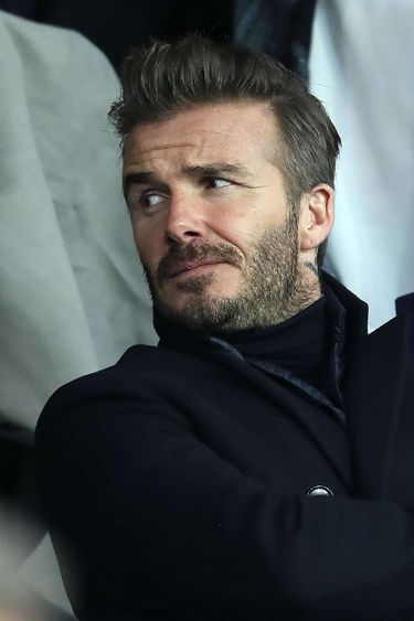 David Beckham przed przeszczepem włosów