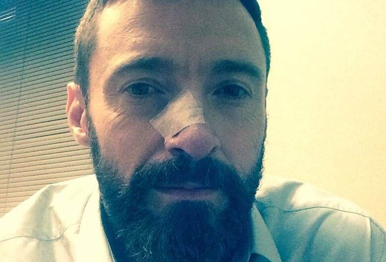 Hugh Jackman po trzeciej operacji usunięcia nowotworu!