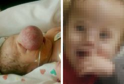 Przez 5 miesięcy nie widziała twarzy dziecka. Lekarze dokonali cudu