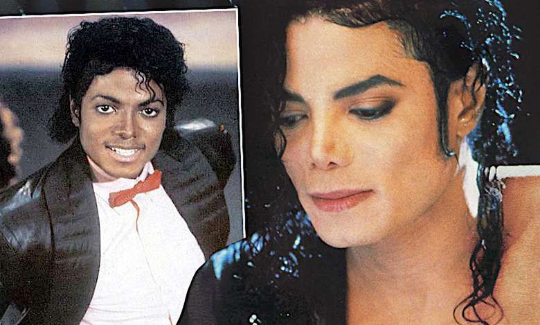 Michael Jackson choroba bielactwo