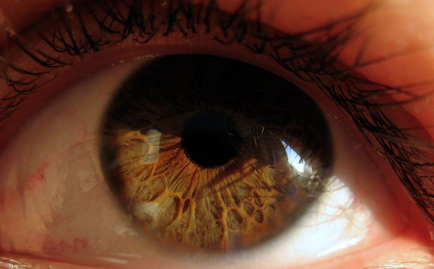 Choroby oczu - oko ludzkie 