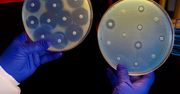 Powstał antybiotyk, który pokonuje nawet superbakterie. I nie wymyślił go człowiek