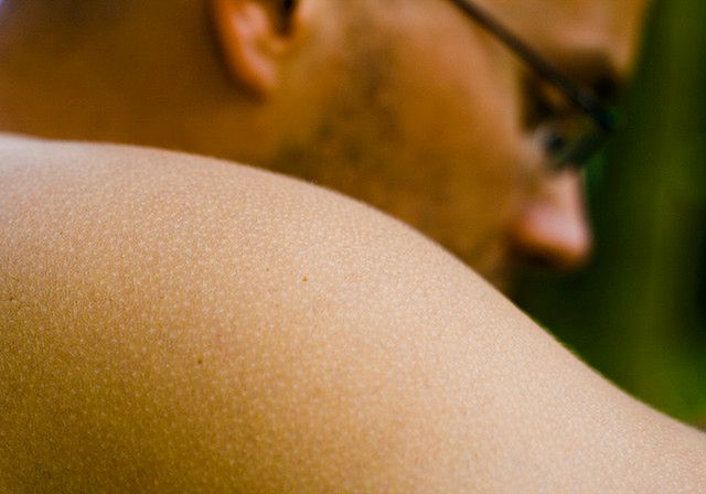 Badania dermatoskopowe zaleca się wykonywać średnio raz w roku