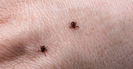 Na 99% masz zawsze przy sobie tę jedną rzecz, która przyciąga kleszcze