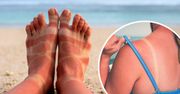 Kiedy zasnęłam na plaży, słońce spiekło mnie na czerwono. Uratował mnie stary patent babci