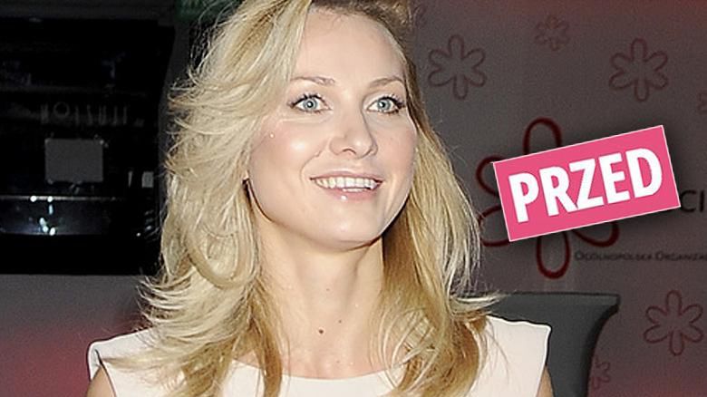 Joanna Moro usunęła pieprzyki z twarzy