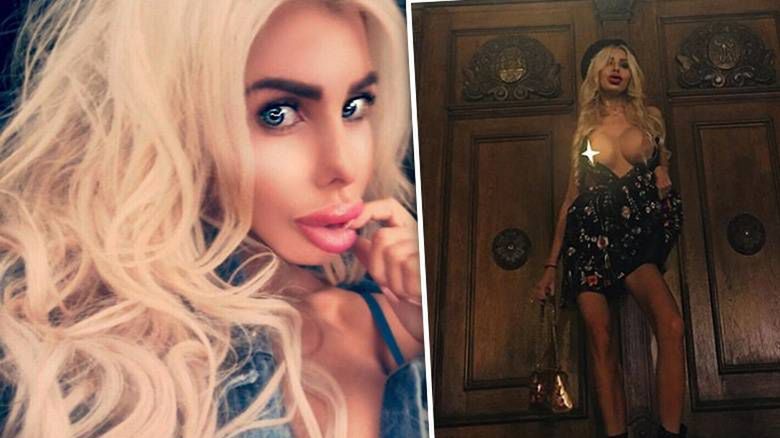 Anella planuje kolejną operację