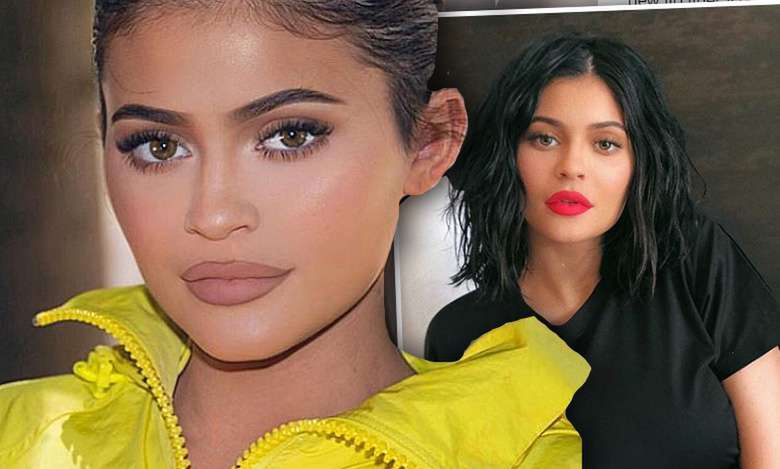 Kylie Jenner usunęła wypełniacze z ust