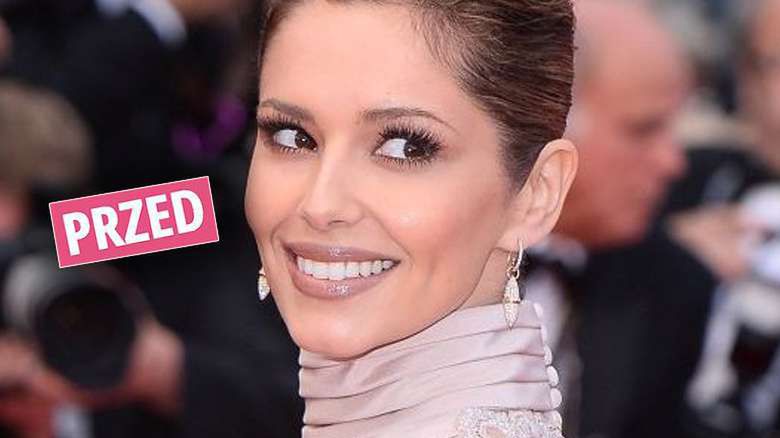 Cheryl Cole miała operację?