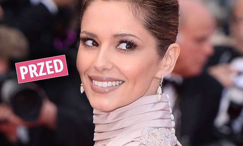 Co się stało z twarzą ślicznej Cheryl Cole? Rewolucyjna zmiana. Także na głowie