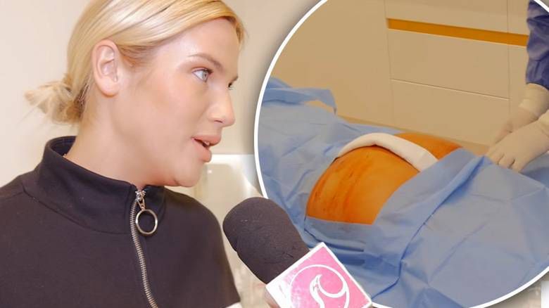 Karolina Gilon powiększyła pośladki