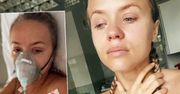 Anna Skura przeszła poważną operację. Wystąpiły powikłania: "Najgorsze 30 minut życia". Konieczna była pilna interwencja lekarzy