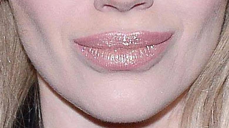 Joanna Majsterak powiększyła usta