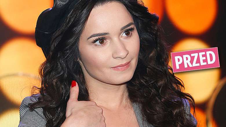 Ewelina Lisowska powiększyła usta