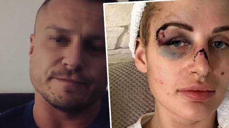 Miłosz P odpowiada na zarzuty pobicia