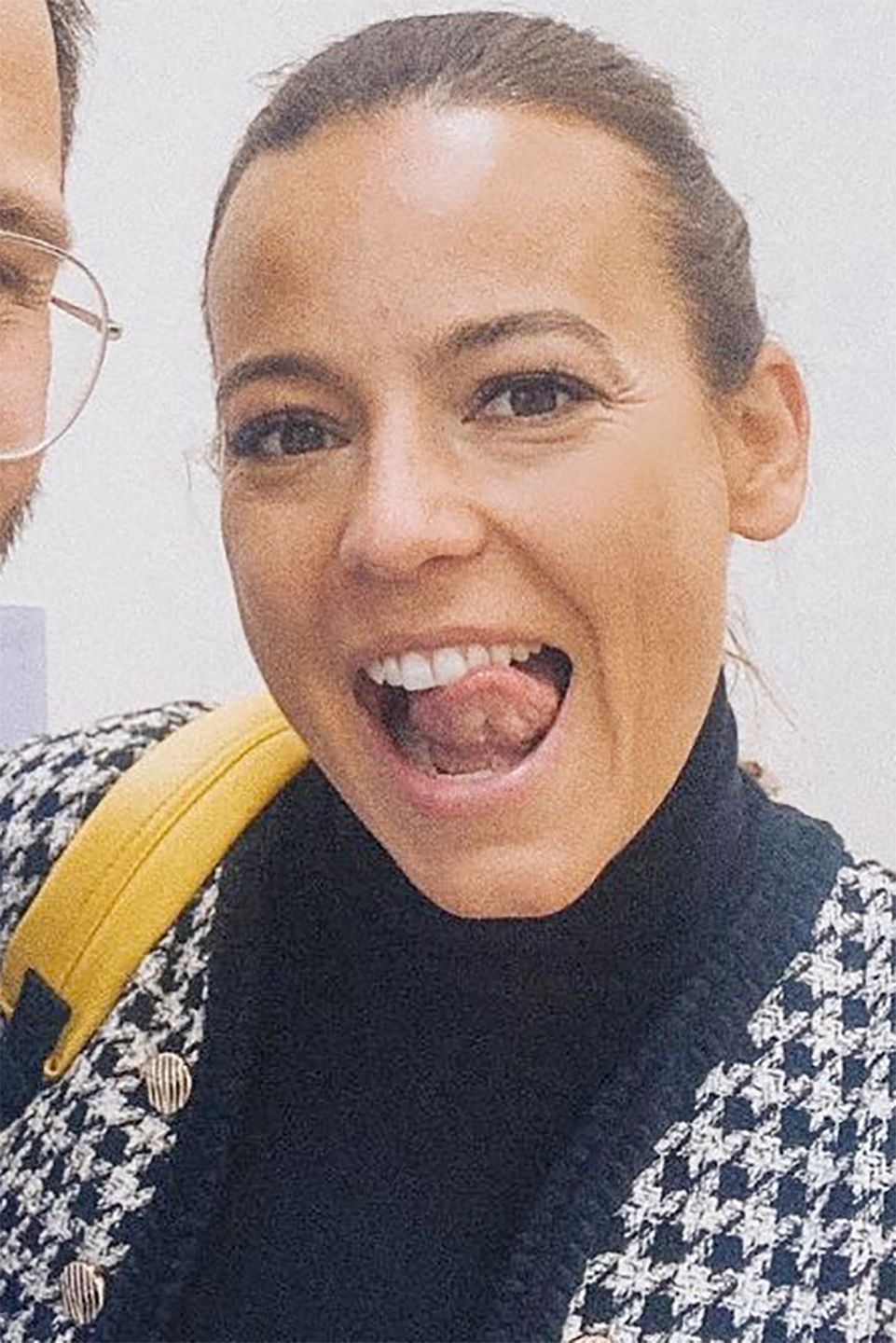 Anna Mucha nowe zęby
