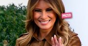 Melania Trump zadziwiła nowym kolorem włosów. Przed końcem kadencji męża przeszła metamorfozę