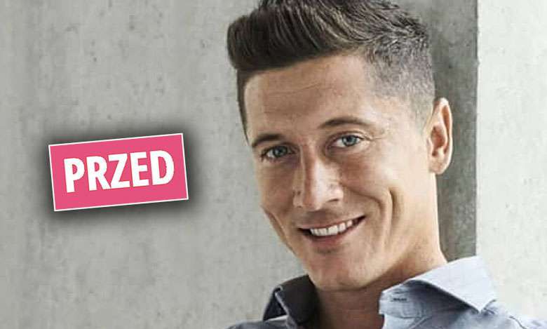 Robert Lewandowski zaszalał z maszynką do włosów! Tak przystojny nie był nawet w blondzie