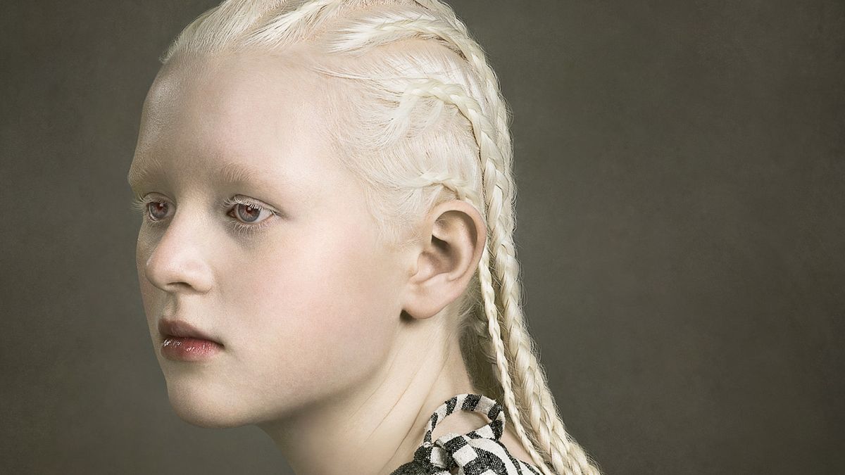Justine Tjallinks opowiada historię albinizmu w swoim projekcie „Jeweled” 1