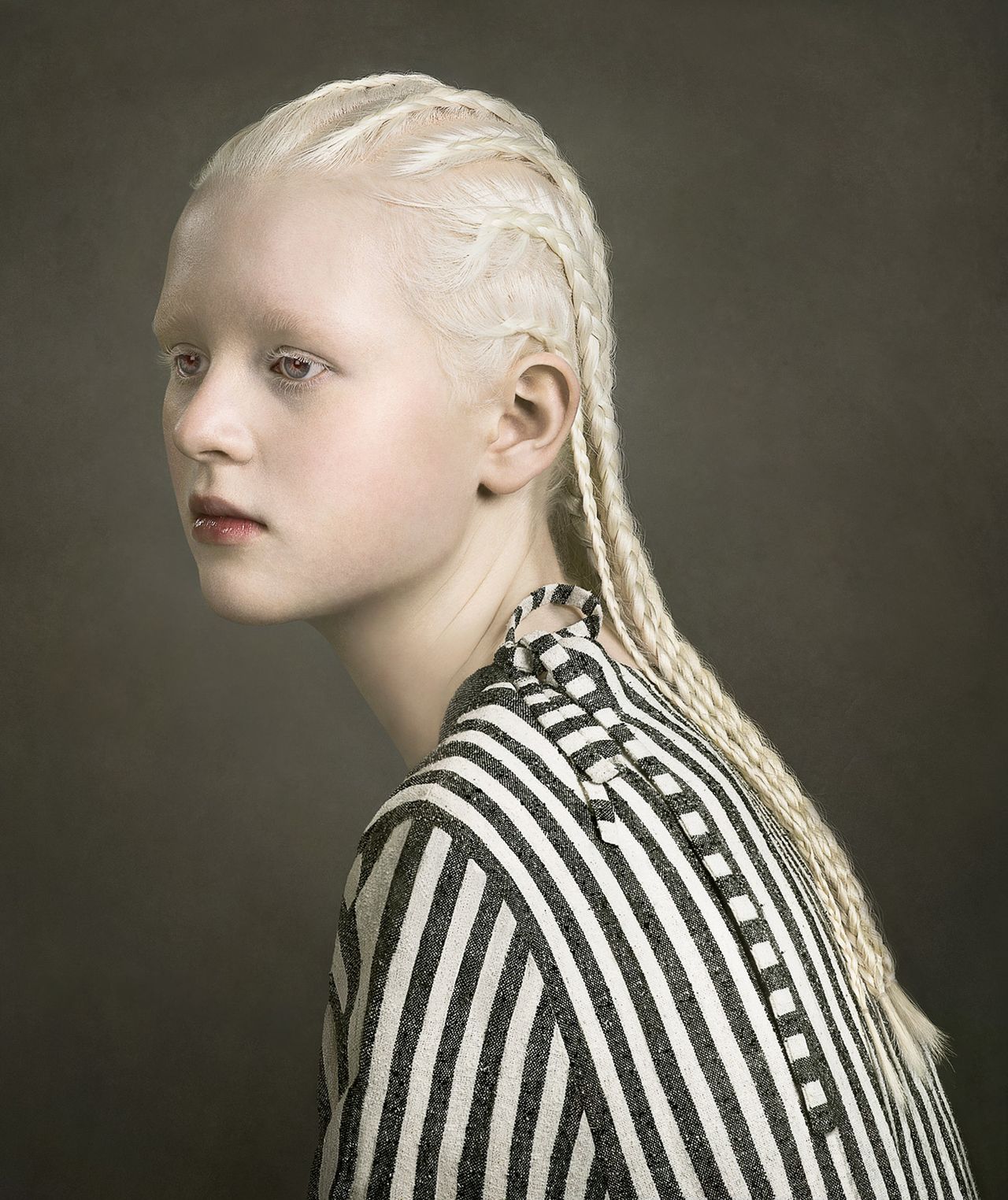 Justine Tjallinks opowiada historię albinizmu w swoim projekcie „Jeweled”