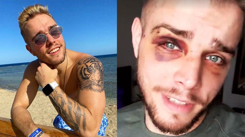 Blondino z "Hotelu Paradise" został pobity i okradziony