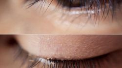 Wszy na sztucznych rzęsach. Lekarze ostrzegają kobiety