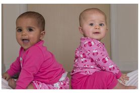 Na świat przyszły bliźniaczki o różnym kolorze skóry