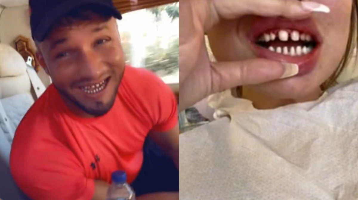 They showed the process of creating "Turkish teeth"