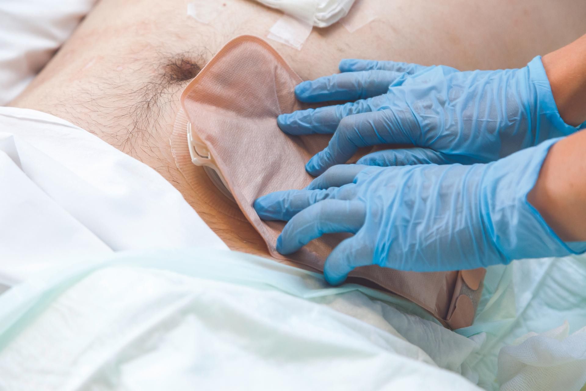 To jeden z najczęściej diagnozowanych w Polsce nowotworów