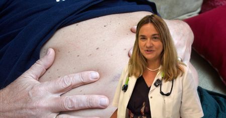 Wycofuje stłuszczenie. Lekarka: To najskuteczniejsza regeneracja wątroby