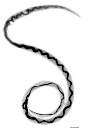 Angiostrongylus cantonensis to pasożyt nicieni 
