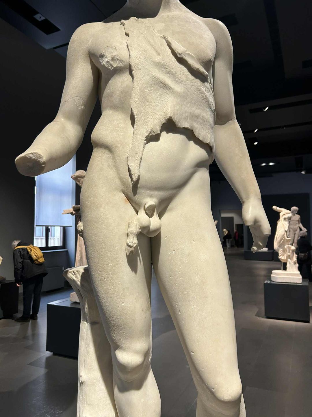 Brak genitaliów to nie zawsze efekt upływu czasu