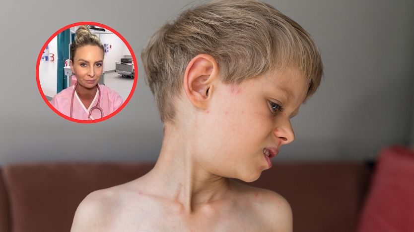 Gdy pojawi się za uchem, pędź do szpitala. To objaw zagrażający życiu