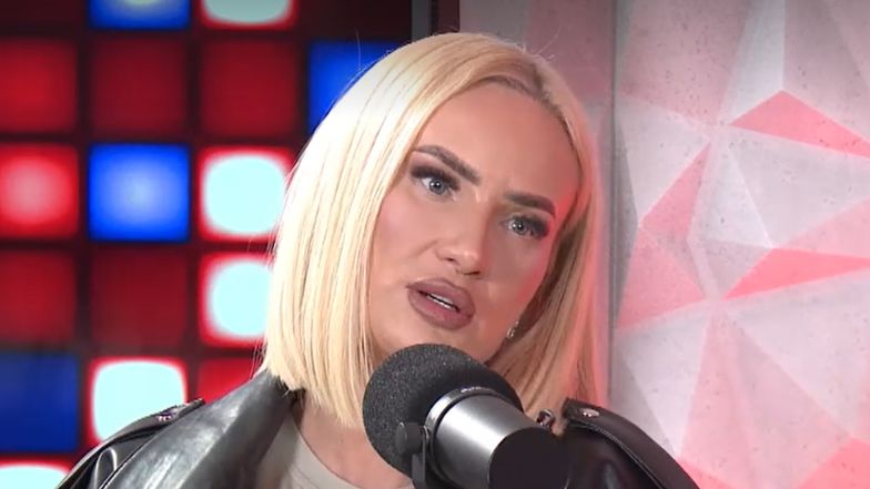 Izabela Macudzińska tłumaczy się z operacji plastycznych