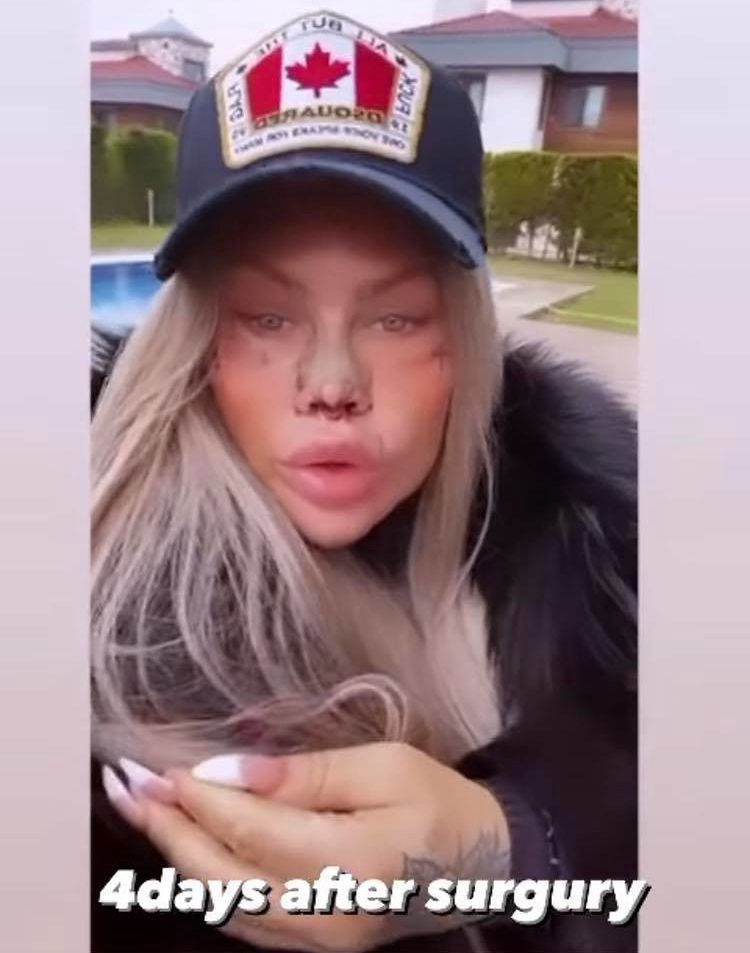 Laluna Unique z "Królowych Życia" po grudniowej operacji w Stanbule