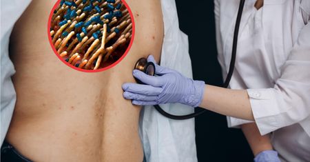 Liczba chorych rośnie lawinowo. 10-krotny wzrost zachorowań w Polsce
