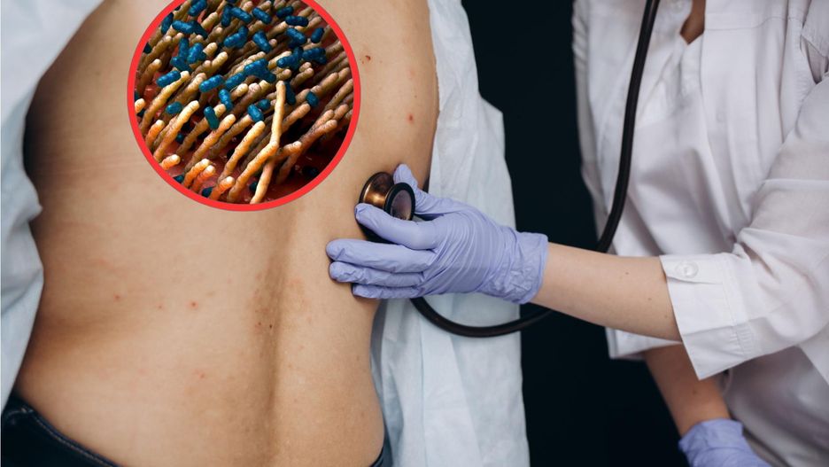 Dramatyczny wzrost przypadków. Fala zachorowań przetacza się przez Europę