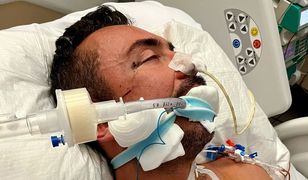 Były dziennikarz TVP dziękuje za drugie życie. Przeżył koszmarny wypadek
