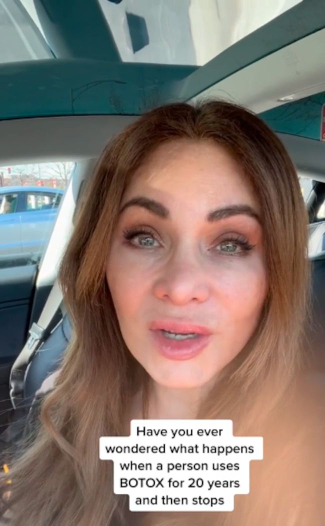 Wstrzykiwała sobie botoks przez 20 lat i przestała. Efekt podzielił internautów