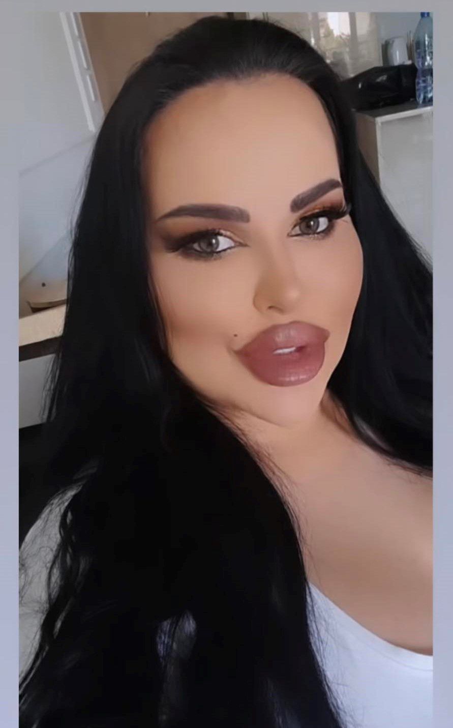 Esmeralda Godlewska jest załamana po liftingu piersi