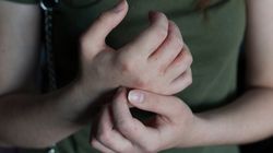 Plamica alergiczna - przyczyny, objawy, leczenie