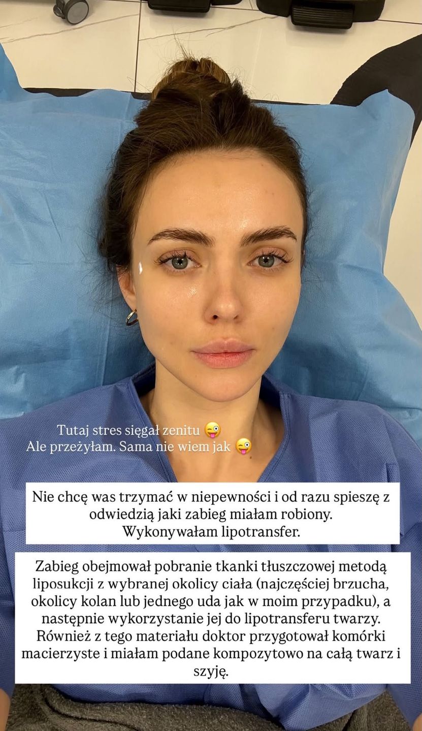 Marcela Leszczak relacjonuje zabieg