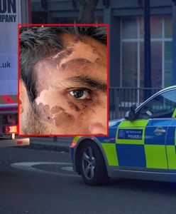 Oblał wrzątkiem policjantów. Wyrok wywołał oburzenie