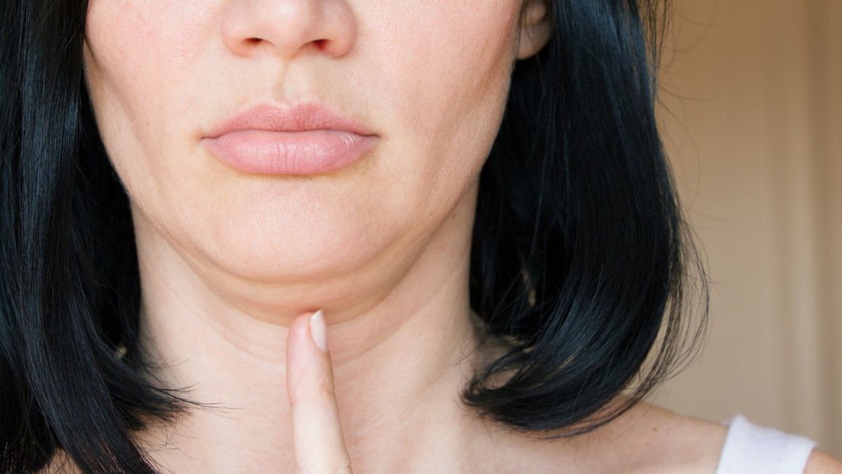 Lifting podbródka to zabieg dla osób, które borykają się z problemem podwójnego podbródka lub obwisłej skóry.