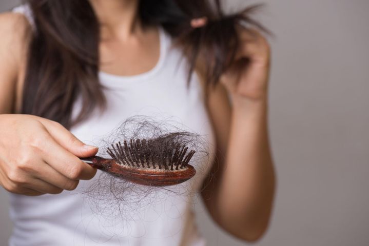 Łysienie telogenowe należy do najczęstszych przyczyn wypadania włosów zarówno u kobiet jak i u mężczyzn.