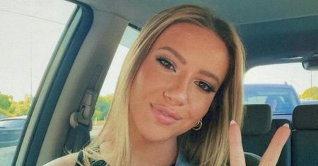 Nietypowa alergia 22-letniej modelki. "Moja dłoń zaczęła puchnąć"
